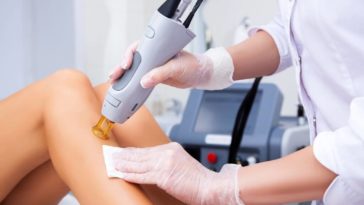 Laser Hair Removal preparation , hair removal , laser hair removal , laser hair removal price , laser hair removal cost