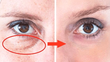 beauty tips for face and body