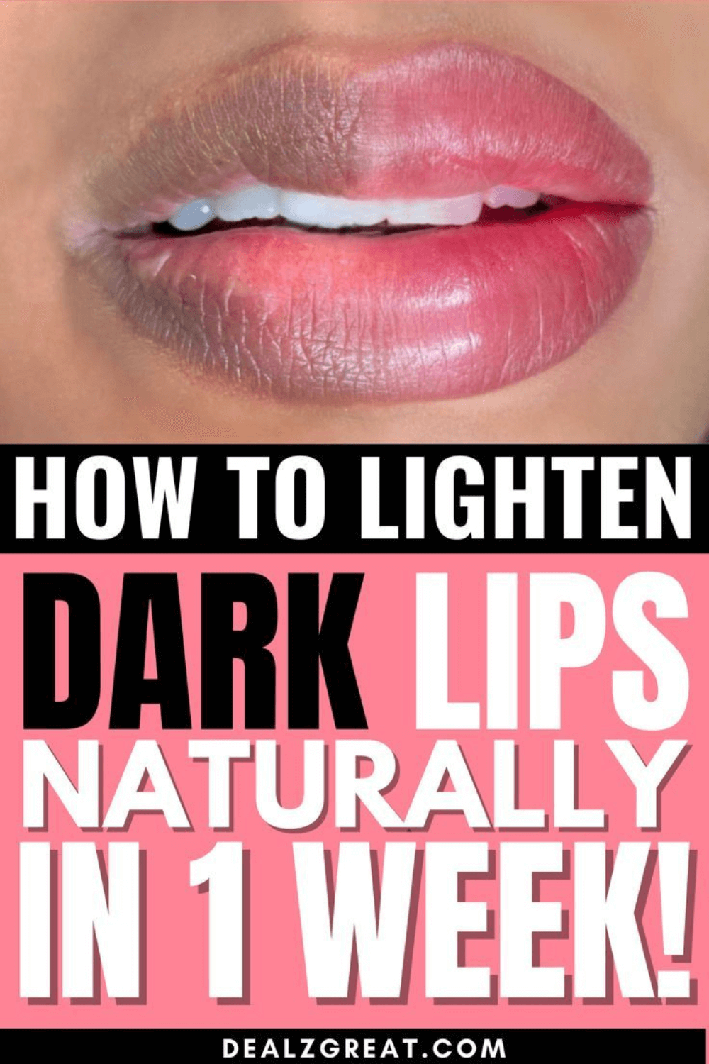 dark lips remedies