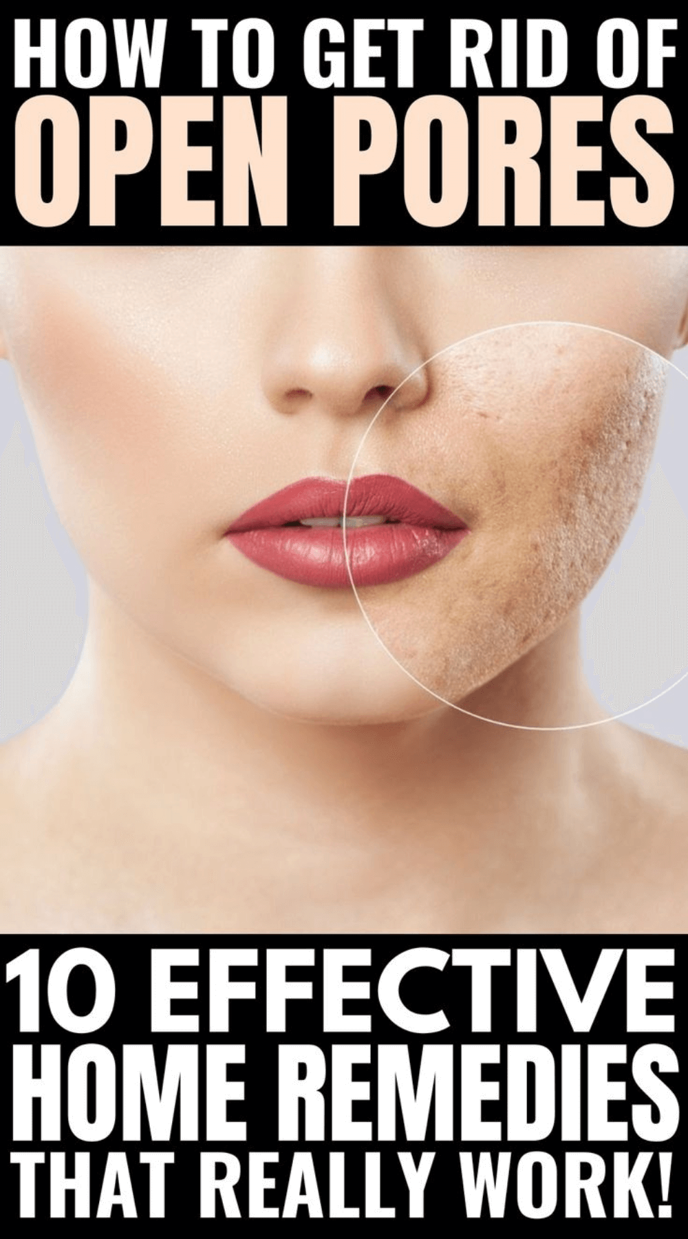 effective home remedies to get rid of open pores