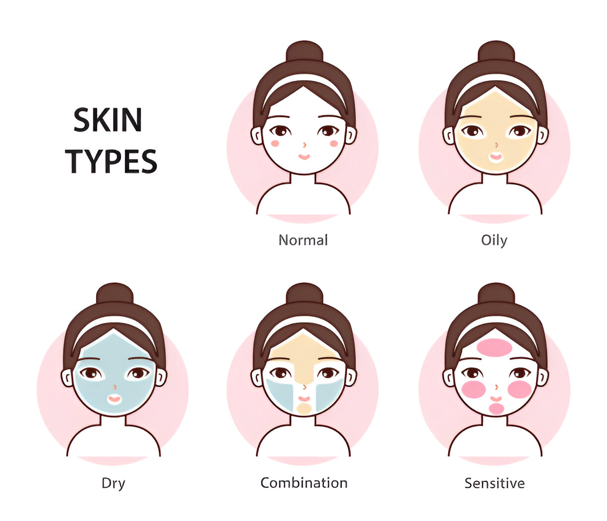 skin types